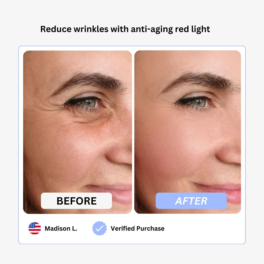 Anti-Wrinkle Beauty Apparatus